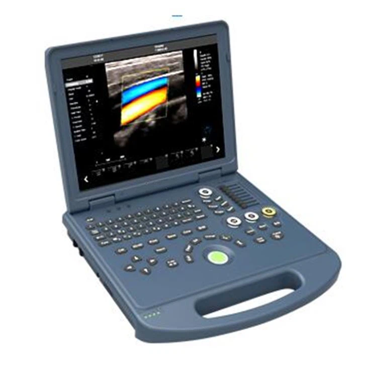 3D Ultrasound Equipment Laptop USG Scanner Doppler