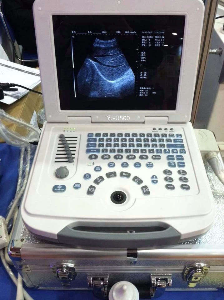 Veterinary Equipment Digital Back Fat Ultrasound Scanner Veterinary Equipment Digital Back Fat Ultrasound Scanner