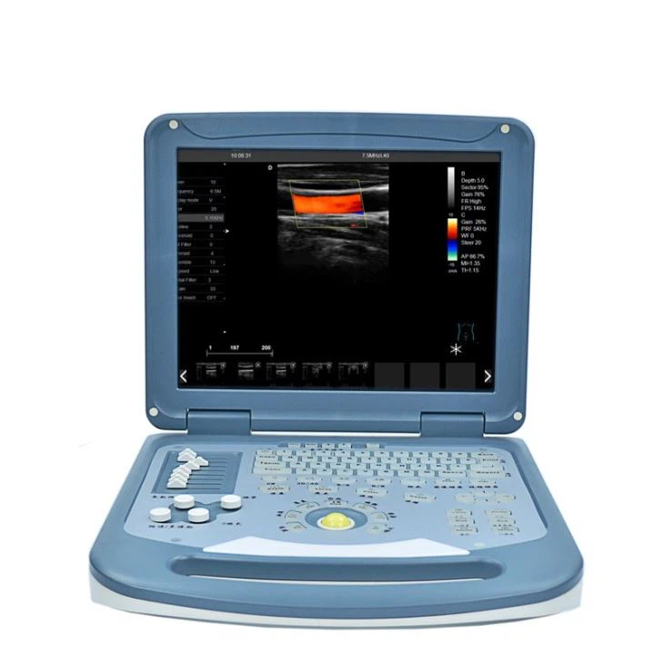 Portable Echocardiography Ultrasound Machines