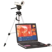 Tuam Tshoj Chaw Tsim Tshuaj Kho Mob Devie Electronic Dndoscope Video Xim Digital Colposcope Sony Rau Obstetrics Thiab Gynecology