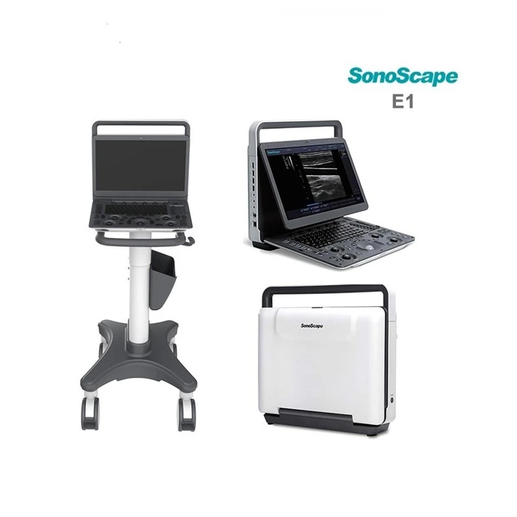 SONOSCAPE E1 usg machine